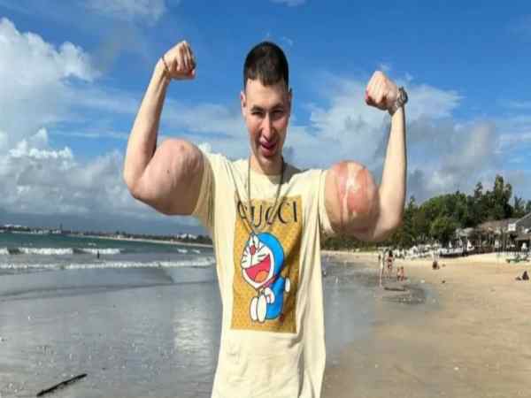 Góc khuất nguy hiểm trong giới thể hình phong trào